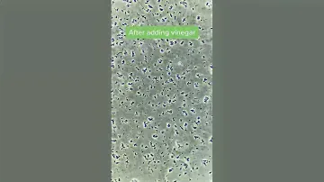 Vinegar VS Bacteria under the microscope!