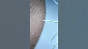 КОЛЮЧКА ПОД МИКРОСКОПОМ